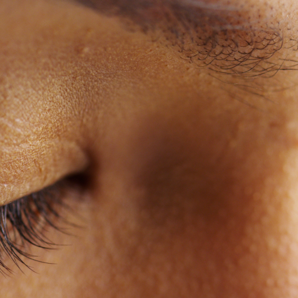 How Your Mental Health Impacts Your Skin Health
