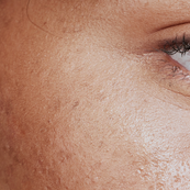 Why Your Skincare’s Best Ingredient is Consistency