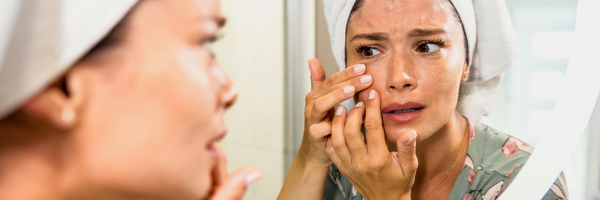 Scary Stuff on Your Skin and How to Keep it in Balance